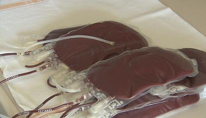 Patientin stirbt nach falscher Blut-Transfusion