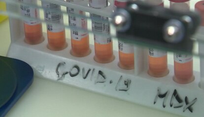 Covid-19, registrati 178 nuovi contagi su 14.233 test. Nessun decesso