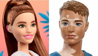 Bambole per l'inclusività: ecco Barbie con l'apparecchio acustico e Ken con la vitiligine